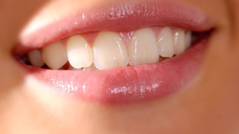 Якщо сняться вставні зуби, про що це може говорити?