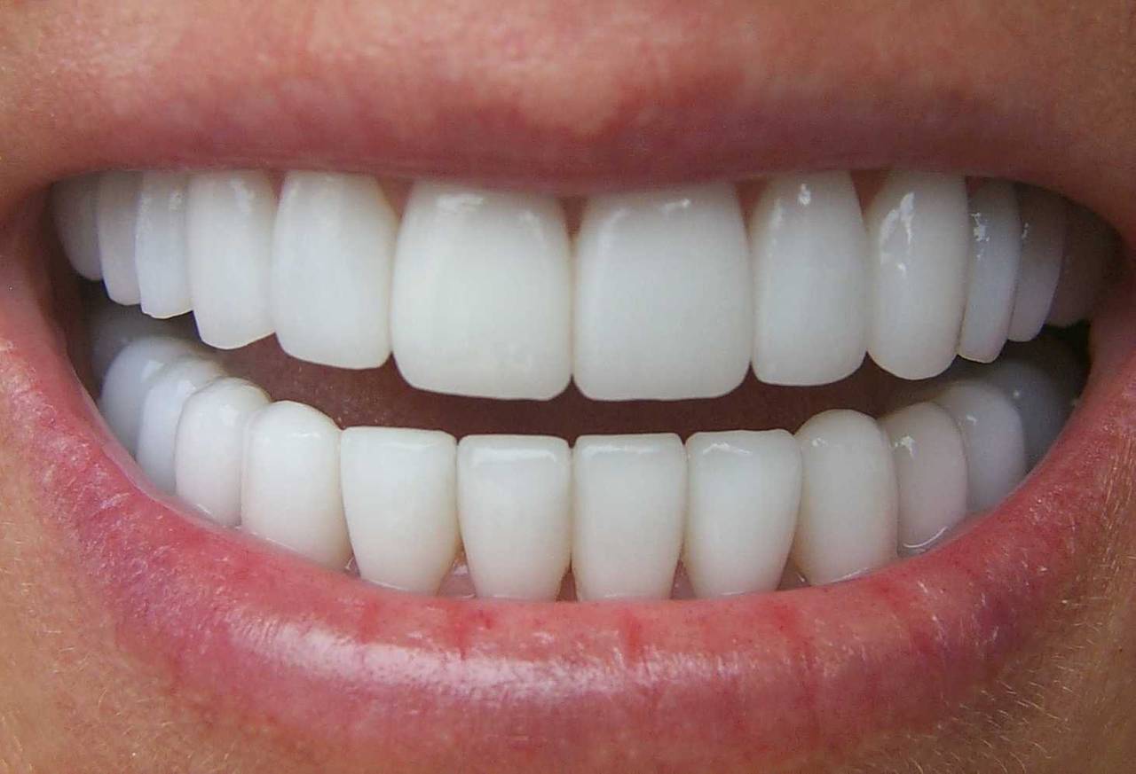 Якщо сняться вставні зуби, про що це може говорити?